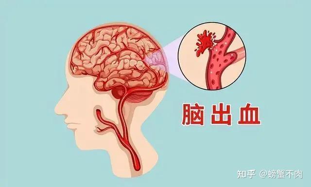 高血压的危害你注意了吗？